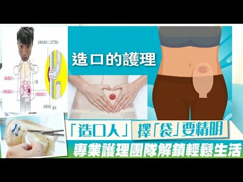 ShareHub | 【造口與日常護理】造口成因|更換造口袋示範| 泌尿造口|結腸造口| 造口人生|造口手術《東東雲吞麵》#新冠肺炎 #香港 ...